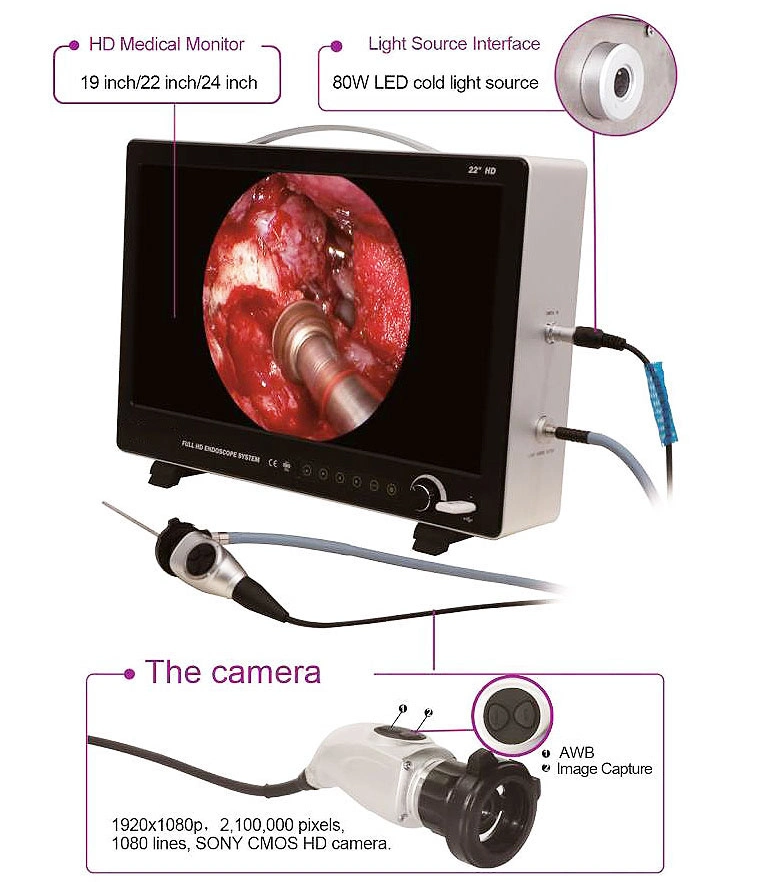 Ltes52 Portable Surgical Endoscopy Camera Medical Endoscope System with Cold Light Source