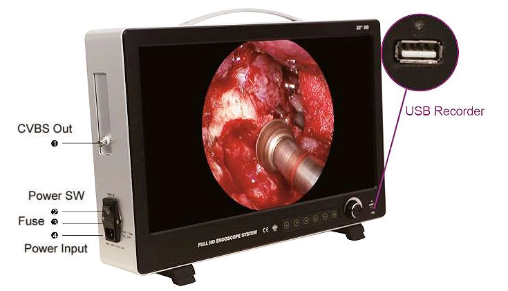 Ltes52 Portable Surgical Endoscopy Camera Medical Endoscope System with Cold Light Source