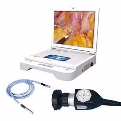 Système de caméra endoscopique portable pour le diagnostic des maladies endoscopiques orl
