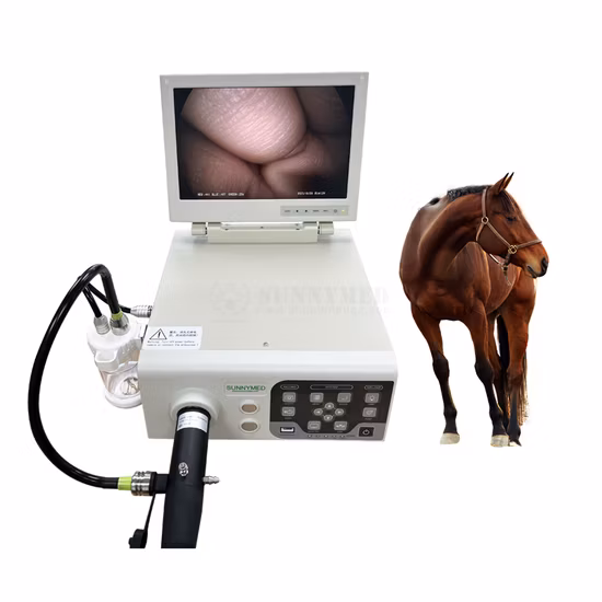 Endoscope portable 1080P tout-en-un, système de caméra endoscopique HD complet